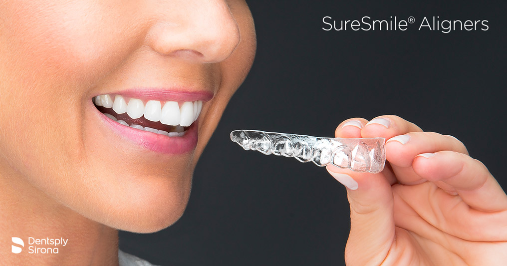 SureSmile® - Clear Braces - Simply Dental, Carol Stream Dentist